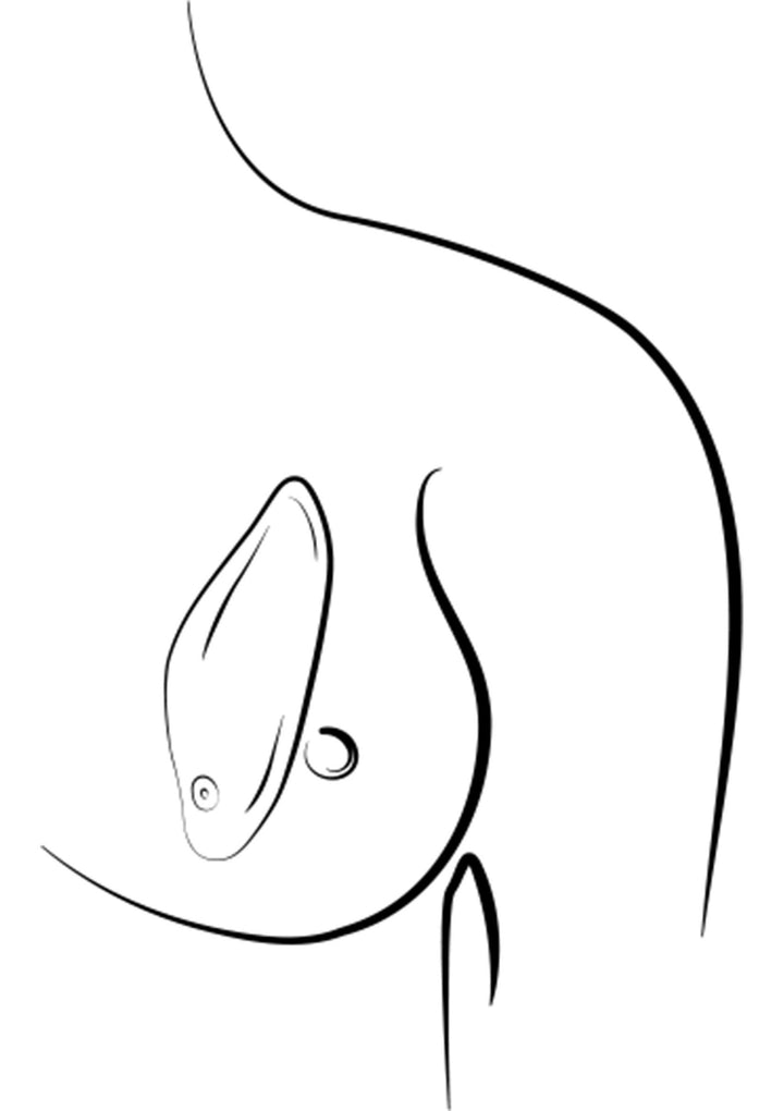 ROMP Wave oplegvibrator